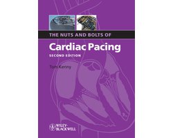 Nuts & Bolts Of Cardiac Pacing