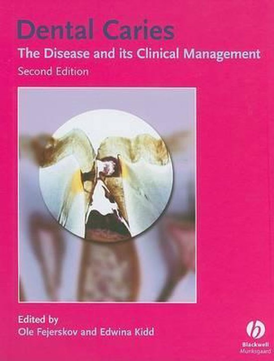 Boek-Dental Caries-tweedehands