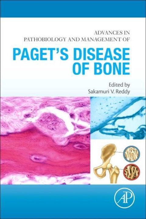 Advances In Pathobiology & Management
