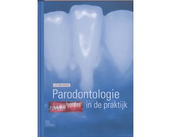 Parodontologie in de Praktijk