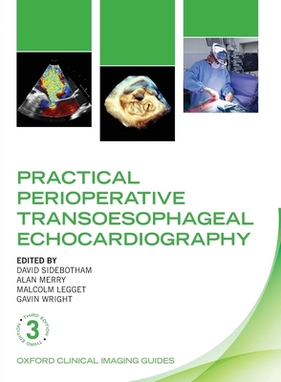 Practical Perioperative Transoesophageal Echocardiography, David Sidebotham e.a., third edition, tweedehands