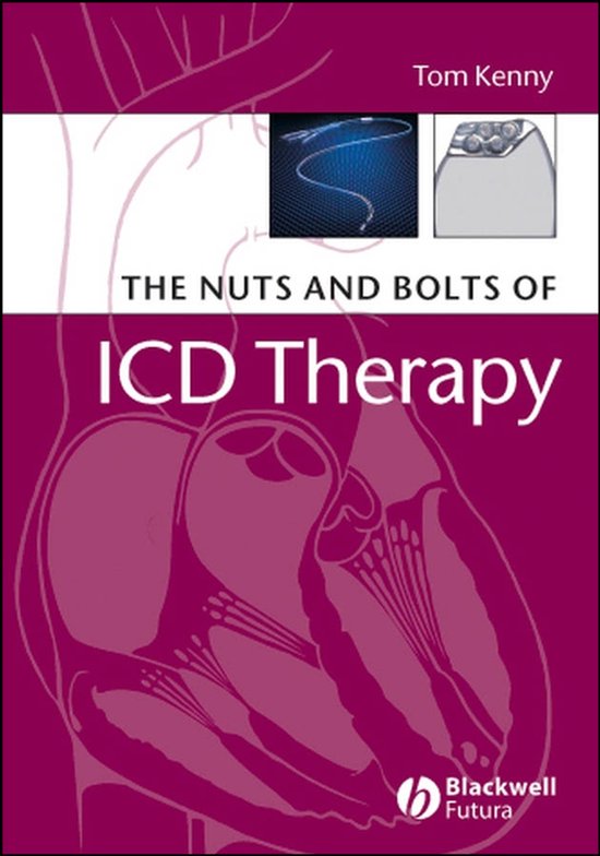 The Nuts and Bolts of ICD Therapy, Tom Kenny, paarsrode omslag met een doorsnede van een hart, tweedehands