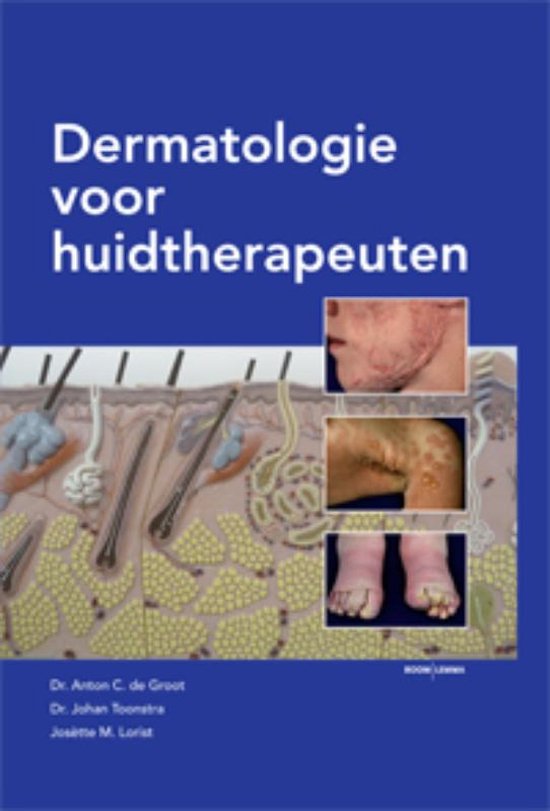 Dermatologie voor huidtherapeuten, Anton C. de Groot e.a., blauwe omslag met een doorsnede van de huid, tweedehands