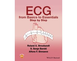ECG from Basics to Essentials